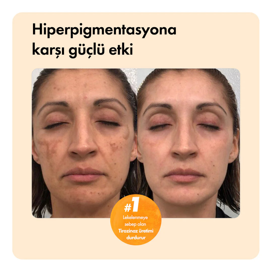 Kojnea Temizleme Barı