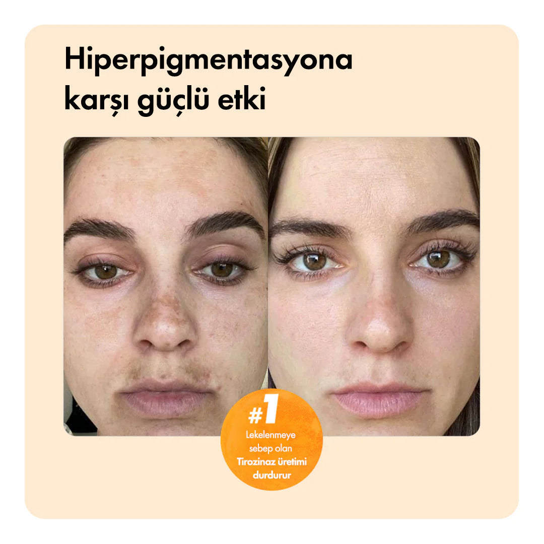 Kojnea Temizleme Barı